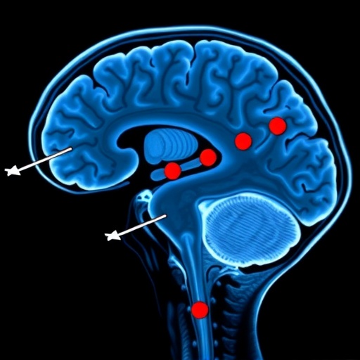 Deep Learning Detects Rem Sleep Disorder And Parkinsons Early Via Fmri 1784010257