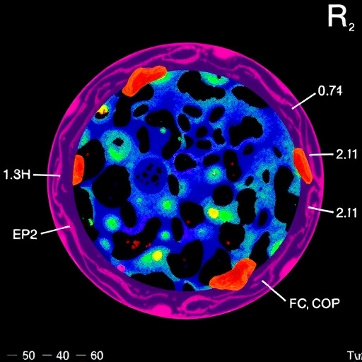 Immunoterapiden Sonra Melanom Tumorunde Bagisiklik Haritasi Yanit Ve Direncle Iliskili Yeni Yolaklar 650Fba98A4