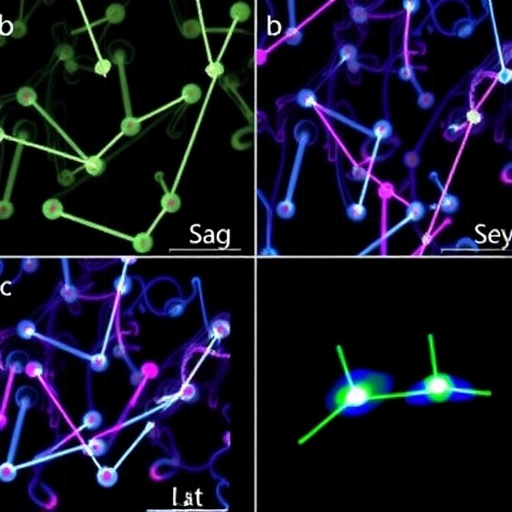 Nanoigne Dizileriyle Dna Okumasiz Uzamsal Gen Duzenleme Haritalamasi Taze Dokuda Post Transkripsiyonel Sinyaller Ffad324Fe5